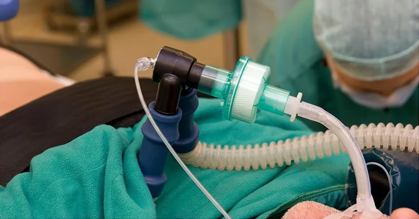 caracteristicas-de-la-aspiracion-traqueal