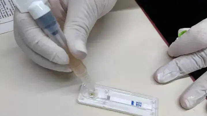 test de detección de cáncer colorrectal
