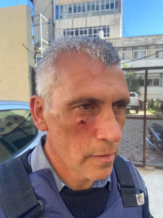 POLICIAS HERIDOS