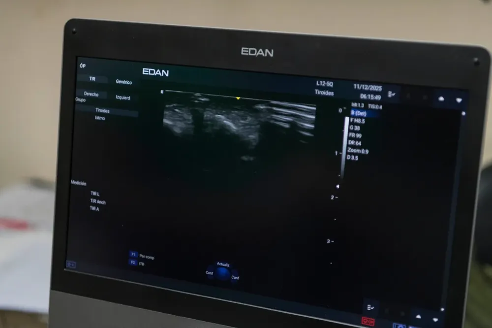 ecógrafos de alta complejidad