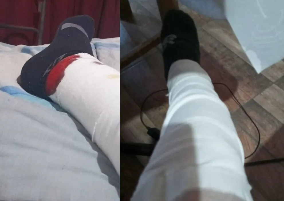 PERROS, ATAQUE, 1016 VIVIENDAS